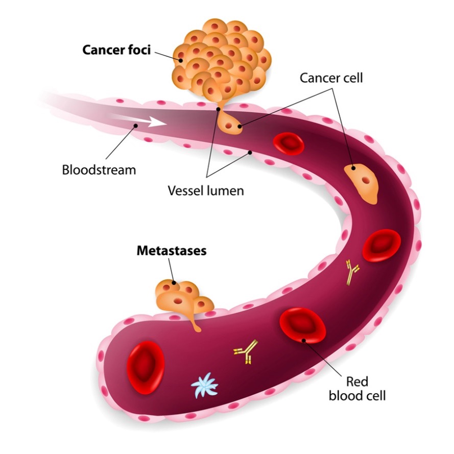 circulatin tumor cells